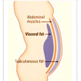 abdominoplastia para gordos Vila Andrade
