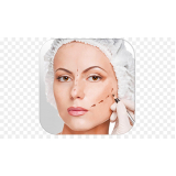 blefaroplastia e botox valor Morumbi