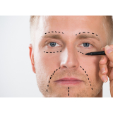 blefaroplastia masculina preço São Paulo