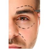 blefaroplastia masculina valor Santo Amaro