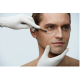 blefaroplastia masculina São Paulo