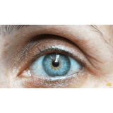 blefaroplastia superior valor Taboão da Serra