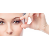 cirurgia blefaroplastia superior Morumbi