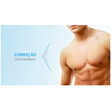 cirurgia ginecomastia a laser valor Vila Andrade