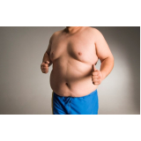 cirurgia ginecomastia bilateral Morumbi