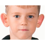 cirurgia na orelha de abano valor Taboão da Serra