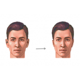 cirurgia na orelha preço Vila Andrade