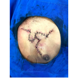 Cirurgia Plástica Reparadora