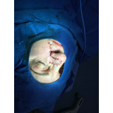 cirurgia plástica reparadora preço Taboão da Serra