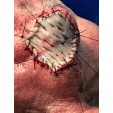 cirurgia plástica reparadora Vila Andrade