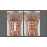 clínica de abdominoplastia em homem Santo Amaro