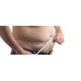 clínica de abdominoplastia masculina Taboão da Serra