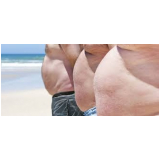clínica de abdominoplastia para gordos Morumbi
