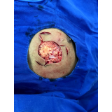 clínica de cirurgia plástica reparadora Santo Amaro