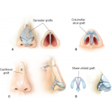 clínica de cirurgia plástica rinoplastia Taboão da Serra