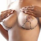 clínica de mamoplastia redutora Morumbi