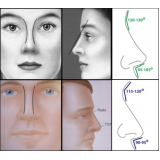 clínica de rinoplastia para nariz largo Vila Andrade