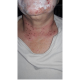 clínica para cirurgia plástica a laser Morumbi