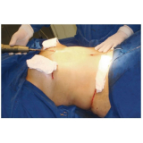 clínica para cirurgia plástica abdominal São Paulo