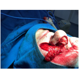 clínica para cirurgia plástica reparadora Taboão da Serra