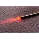 lipoaspiração a laser São Paulo