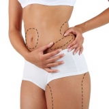 Lipoaspiração para Afinar a Cintura