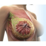 Mamoplastia Bico Invertido