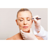 onde encontro blefaroplastia e botox Taboão da Serra