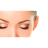 onde encontro cirurgia blefaroplastia superior São Paulo