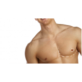 onde encontro cirurgia ginecomastia bilateral Morumbi