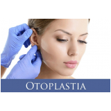 onde encontro cirurgia na orelha de abano Vila Andrade