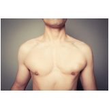 onde encontro ginecomastia masculina cirurgia Morumbi