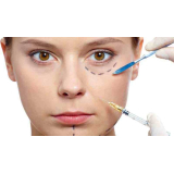 onde encontro preenchimento na área dos olhos Vila Andrade