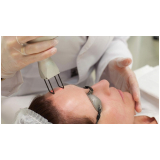 onde encontro tratamento de pele a laser co2 Santo Amaro