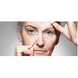 onde encontro tratamento de pele com laser São Paulo