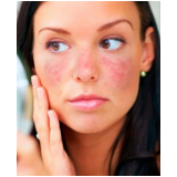 onde encontro tratamento de pele manchas São Paulo