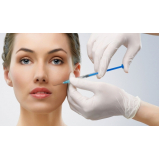 preenchimento bigode chines valor São Paulo