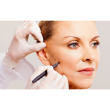 preenchimento facial com gordura preço Vila Andrade