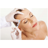 preenchimento na testa Morumbi