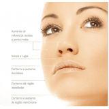 preenchimento no rosto preço Santo Amaro