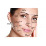 preenchimento no rosto Morumbi