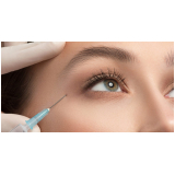 preenchimento olheiras preço Vila Andrade