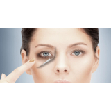 preenchimento olheiras valor Santo Amaro