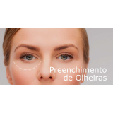 preenchimento para olheiras valor Morumbi