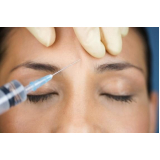 Preenchimento na Testa