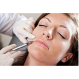 Preenchimento para Bigode Chines