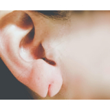 quanto custa cirurgia para rasgo na orelha Vila Andrade