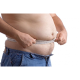 quanto custa lipoaspiração de barriga masculina Taboão da Serra