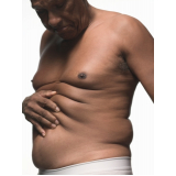 quanto custa lipoaspiração de barriga Vila Andrade