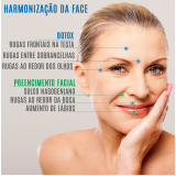 quanto custa preenchimento no rosto Vila Andrade